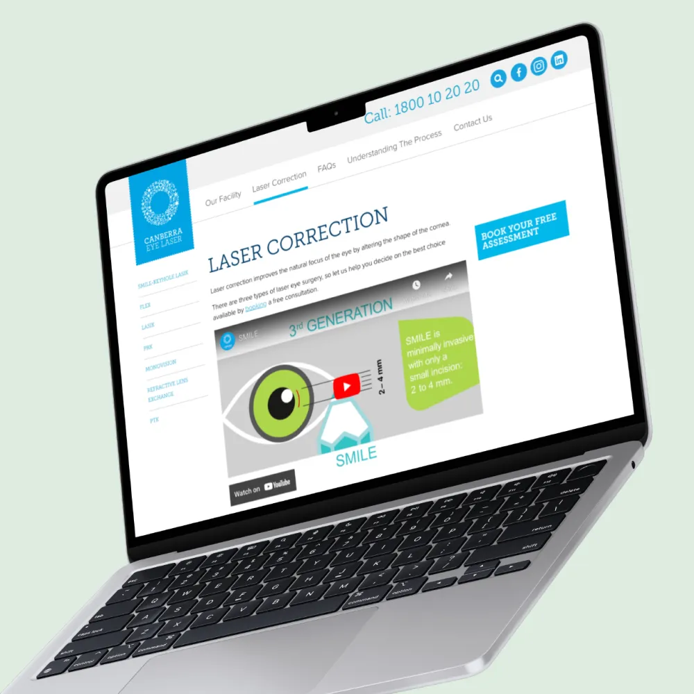 Canberra Eye Laser-03